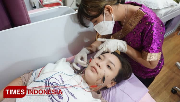 Teknologi Laser Fractional Bisa Atasi Strech Mark dan Kulit Bopeng Bekas Jerawat
