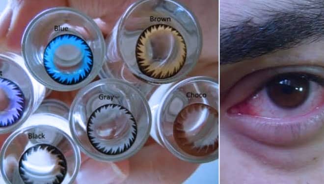 Bahaya Menggunakan Softlens Terlalu Lama