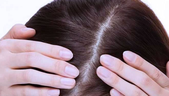 Simak Tips Menjaga Kulit Kepala Selalu Sehat