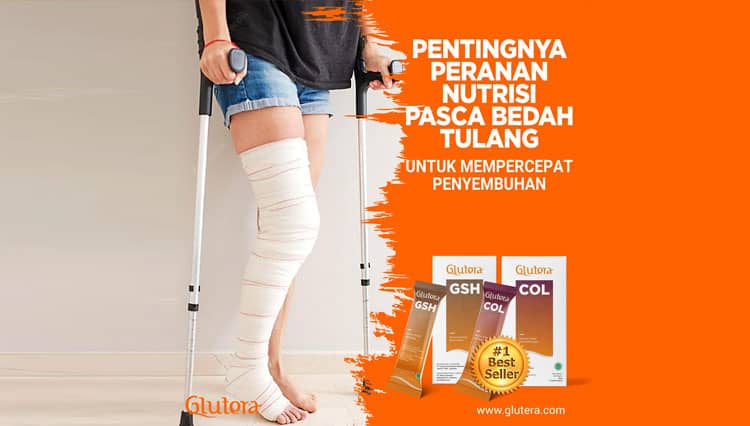 Nutrisi Terbaik Pasca Bedah Tulang untuk Percepat Penyembuhan