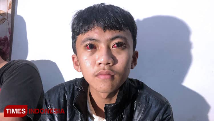 Efek Gas Air Mata di Kanjuruhan, Mata Raffi Memerah Pekat dan Pingsan 2 Jam