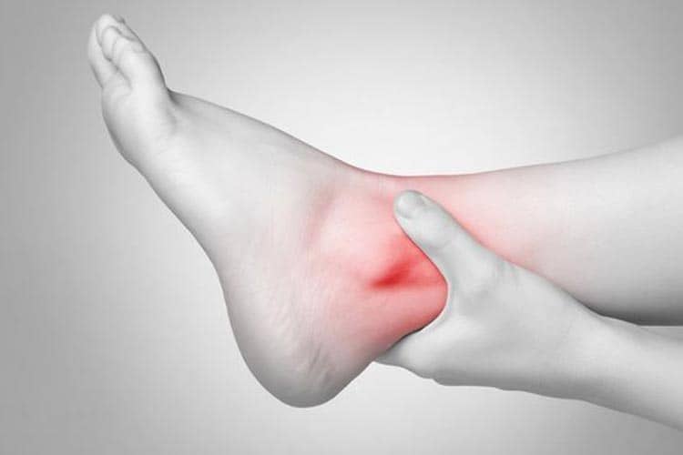 Pergelangan Kaki Cedera atau Keseleo? Dokter Ortopedi: Jangan Langsung Dipijat!