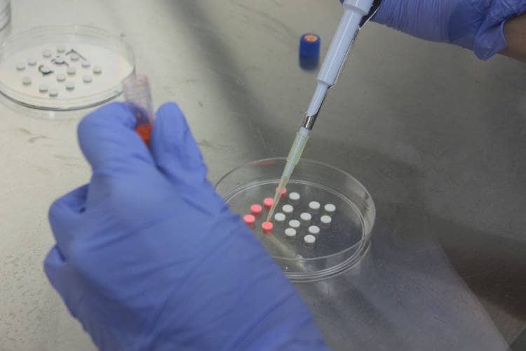 Riset Mahasiswa UGM: Obat Antipsikotik Tawarkan Harapan Baru Atasi Infeksi Jamur Resisten