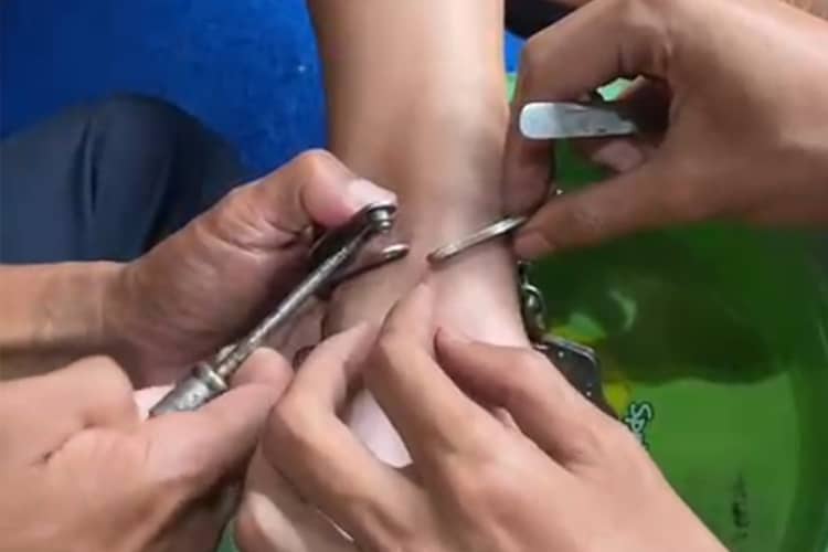 Remaja di Bondowoso Dievakuasi Petugas Damkar Setelah Tangan Terjebak Borgol