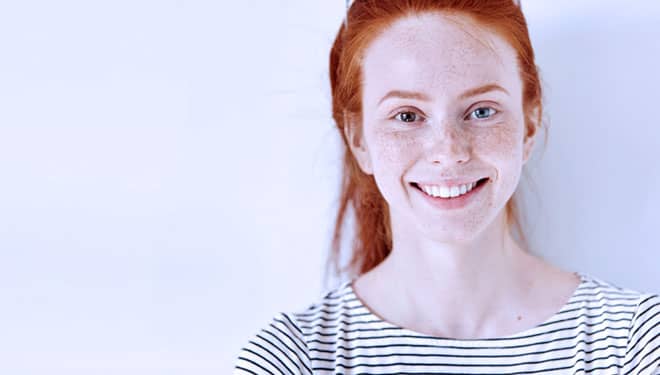 Mengenal Heterochromia, Penyebab Warna Mata Berbeda