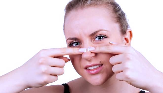 8 Ways to Get Rid of Blackheads