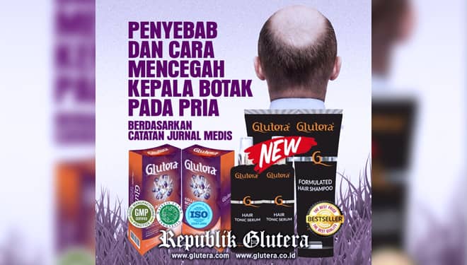 Penyebab dan Cara Mencegah Kebotakan pada Pria