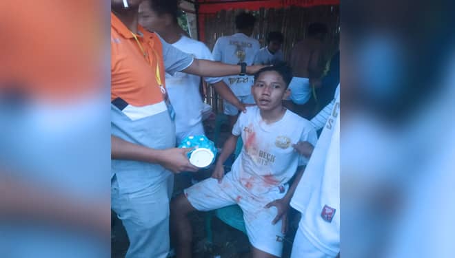 Viral di Facebook, Peserta Turnamen All Star Cup Genteng Bersimbah Darah