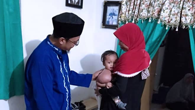 Revalina Hanum, Bayi di Gresik Idap Hygroma Colli