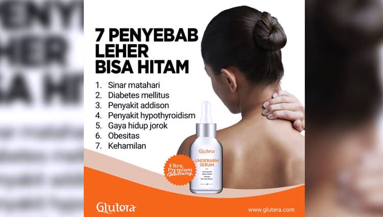 7 Penyebab Leher Hitam
