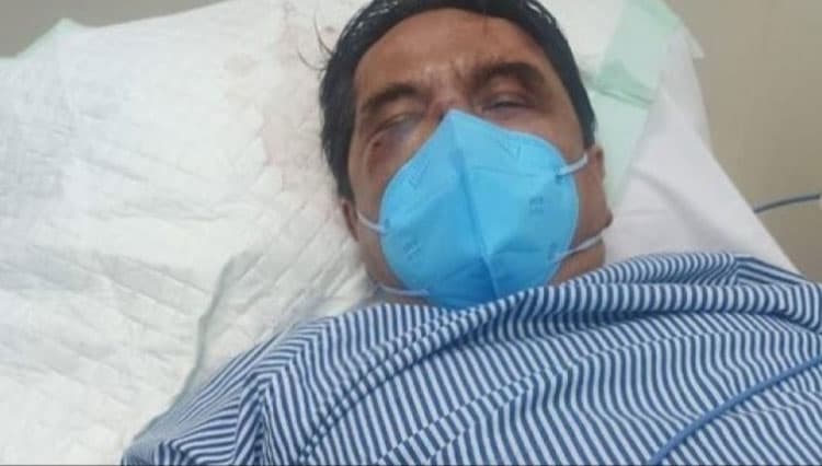 Dengan Tubuh Penuh Perban, Ade Armando Diperiksa Penyidik Polda Metro Jaya