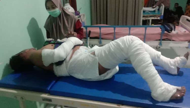 Dua Korban Kebakaran Rumah di Krucil Probolinggo Akan Menjalani Operasi