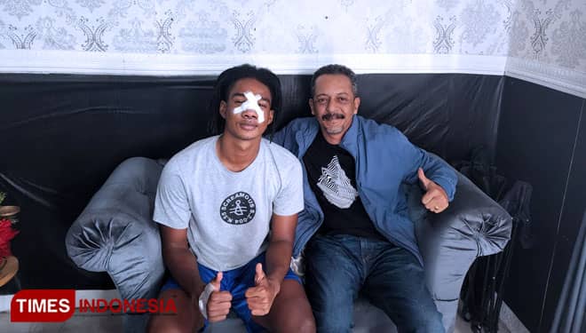 Ronaldo Cedera Hidung, Dirut PBMB Beri Dukungan Moral