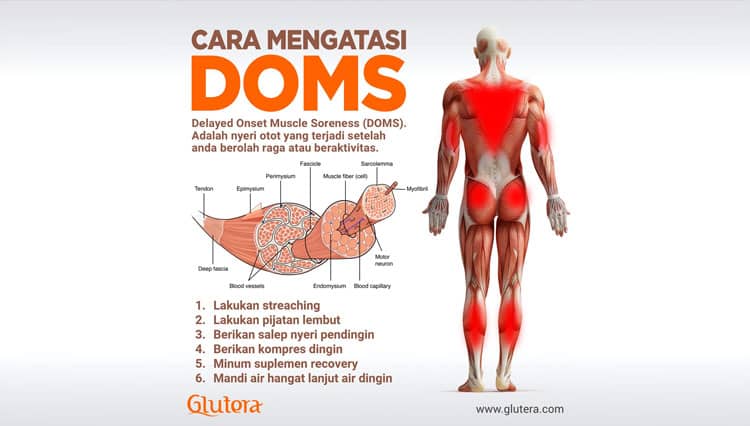 Cara Mengatasi DOMS, Nyeri Otot Setelah Berolahraga