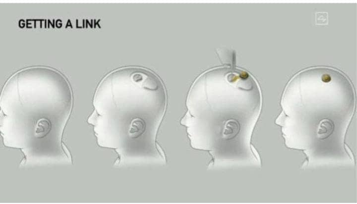 Neuralink Dapat Izin FDA: Bagaimana Cara Kerja Chip Itu di Otak Manusia?