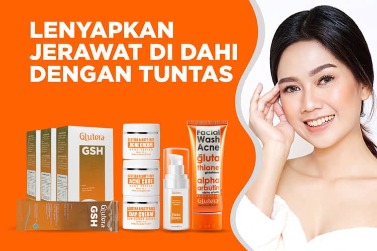 Penyebab Jerawat di Dahi, Bagaimana Cara Menghilangkannya?