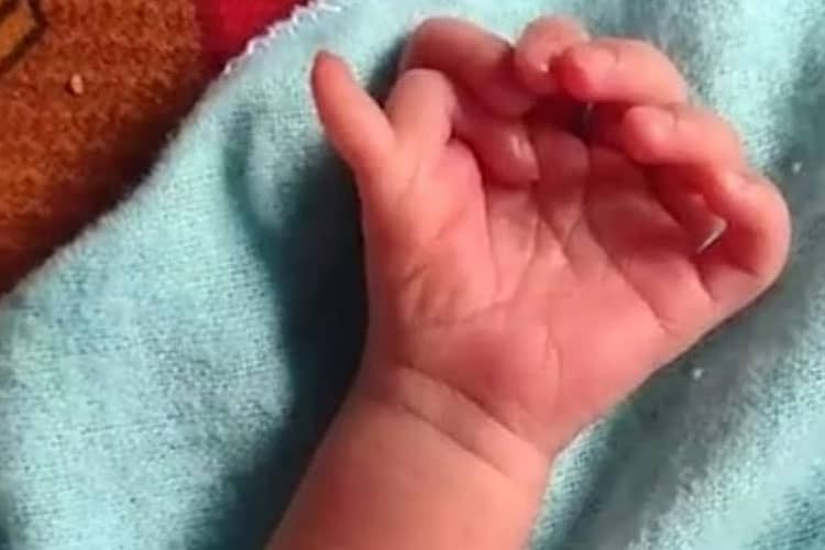 Bayi Lahir dengan 26 Jari Kaki dan Tangan Dianggap Sebagai Titisan Dewi Hindu