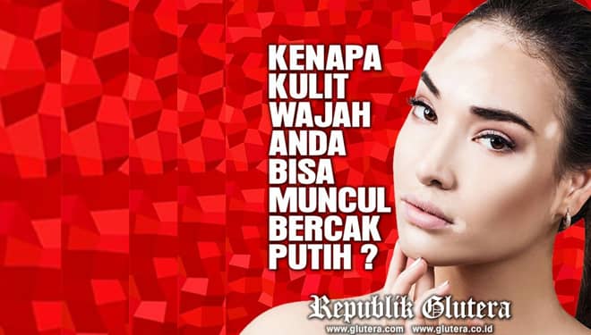 Muncul Bercak Putih di Wajah, Apa Penyebabnya?