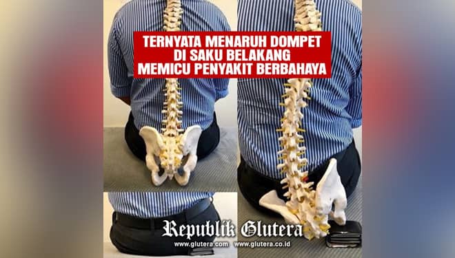 Awas! Menaruh Dompet di Saku Belakang Memicu Penyakit