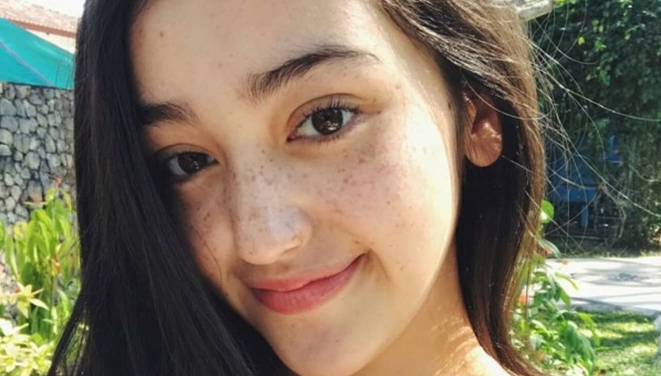 Empat Langkah Mudah Mencegah Freckles pada Wajah