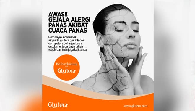 Waspadai, Alergi Panas dan Cara Mengatasinya