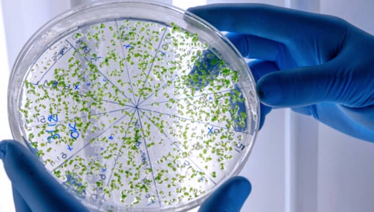 dr Fanny: Selain Nutrisi, Ada Microbiome untuk Tingkatkan Imun Tubuh