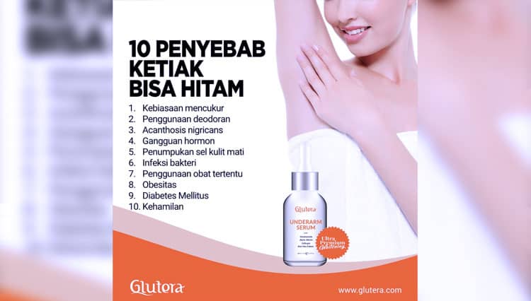 10 Penyebab Ketiak Hitam dan Cara Mengatasinya