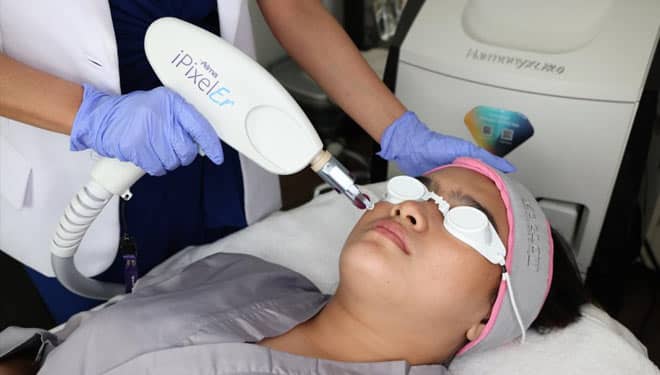 Laser Fractional Treatment MS Glow, Kulit Mulus Bebas Bopeng