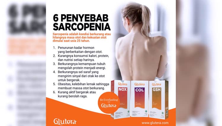 Sarcopenia, Kondisi Hilang Massa dan Kekuatan Otot