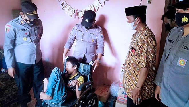 Butuh Uluran Tangan, Remaja 16 Tahun di Probolinggo Ini Menderita Kelainan Kongenital