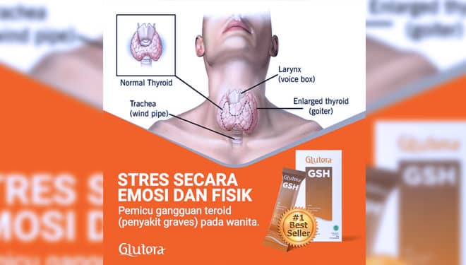 Stres Secara Emosional dan Fisik Picu Gangguan Teroid pada Wanita