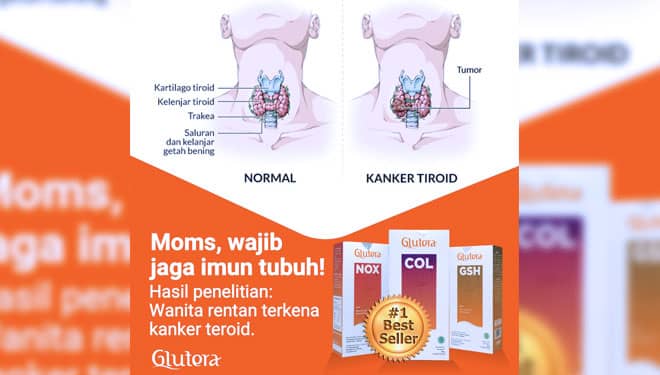 Kenapa Wanita Rawan Terkena Kanker Teroid?